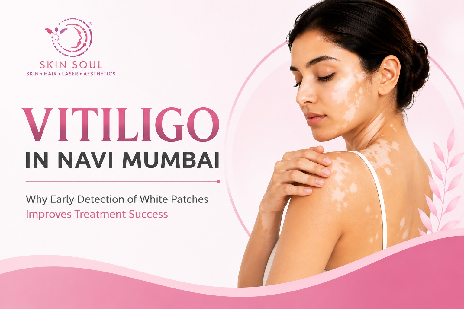 Vitiligo Treatment In Navi Mumbai