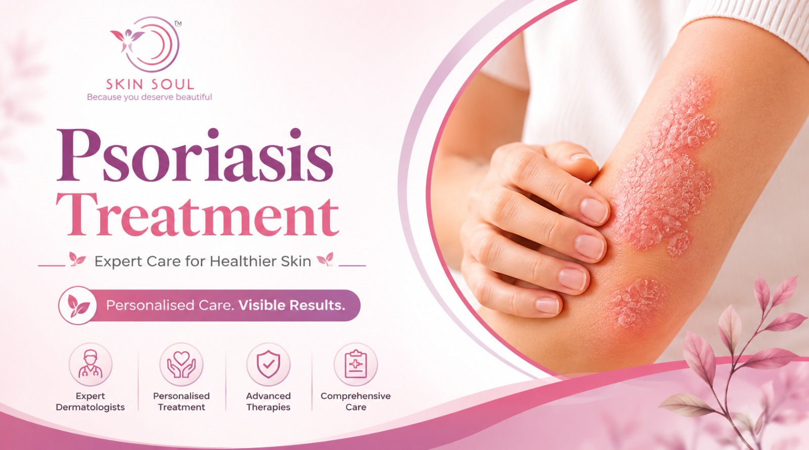 Psoriasis Treatment In Navi Mumbai